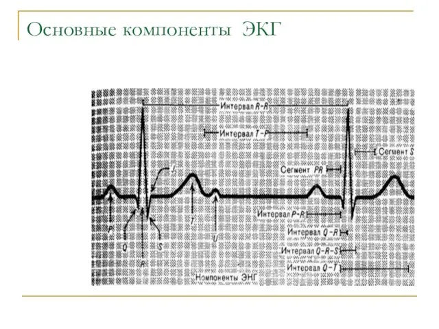 Основные компоненты ЭКГ