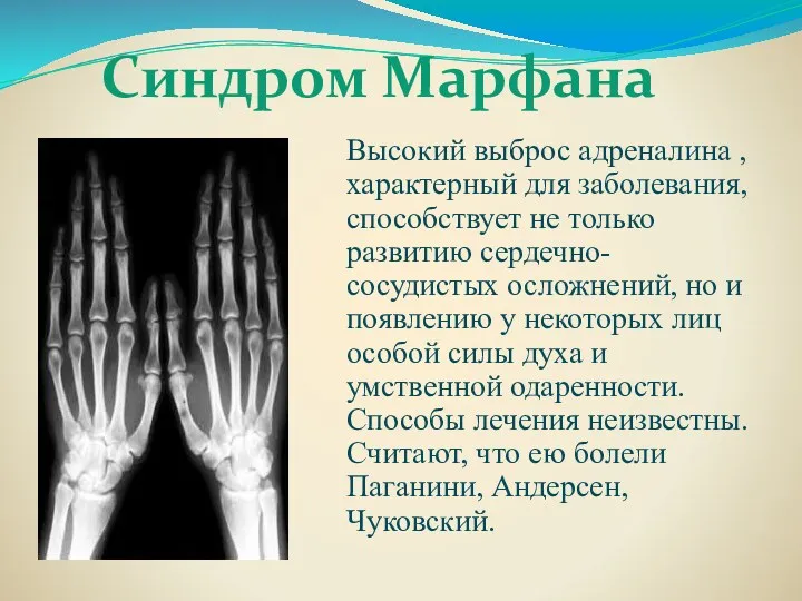 Синдром Марфана Высокий выброс адреналина , характерный для заболевания, способствует