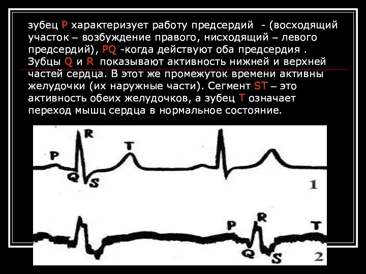 зубец Р характеризует работу предсердий - (восходящий участок – возбуждение