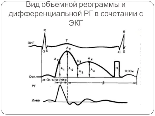 Вид объемной реограммы и дифференциальной РГ в сочетании с ЭКГ
