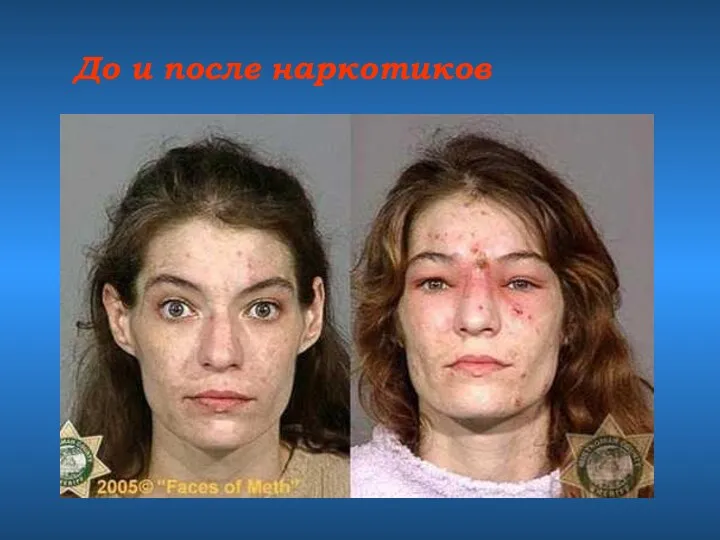 До и после наркотиков