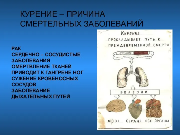 КУРЕНИЕ – ПРИЧИНА СМЕРТЕЛЬНЫХ ЗАБОЛЕВАНИЙ РАК СЕРДЕЧНО – СОСУДИСТЫЕ ЗАБОЛЕВАНИЯ