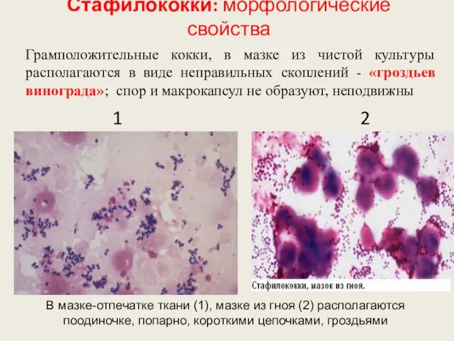 Стафилококки: морфологические свойства В мазке-отпечатке ткани (1), мазке из гноя