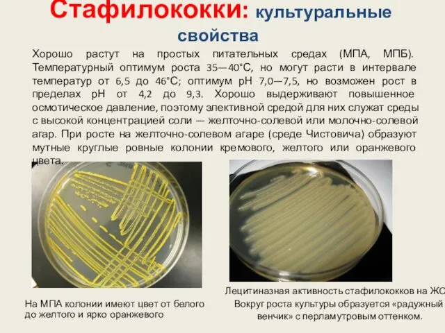 Стафилококки: культуральные свойства Лецитиназная активность стафилококков на ЖСА Вокруг роста