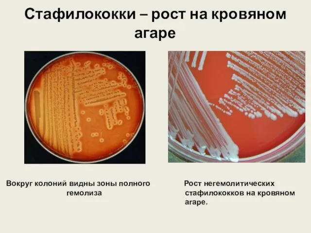 Стафилококки – рост на кровяном агаре Вокруг колоний видны зоны полного гемолиза Рост