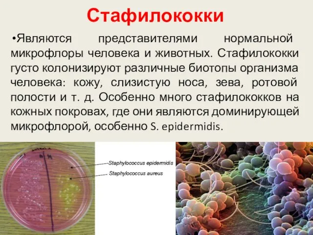 Стафилококки Являются представителями нормальной микрофлоры человека и животных. Стафилококки густо