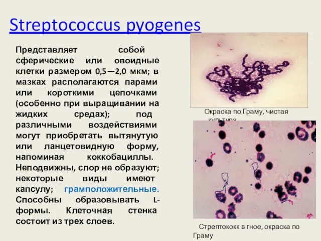 Streptococcus pyogenes Окраска по Граму, чистая культура Стрептококк в гное, окраска по Граму