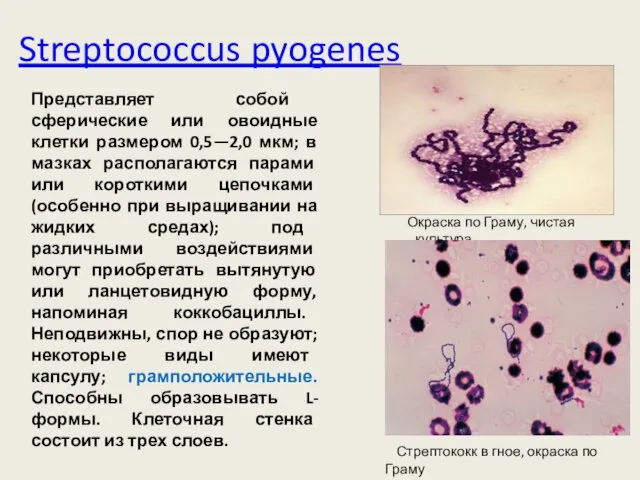 Streptococcus pyogenes Окраска по Граму, чистая культура Стрептококк в гное,