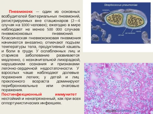 Пневмококк — один из основных возбудителей бактериальных пневмоний, регистрируемых вне стационаров (2—4 случая
