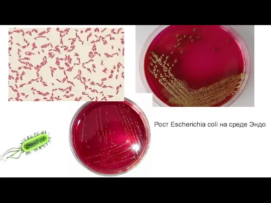 Рост Escherichia coli на среде Эндо