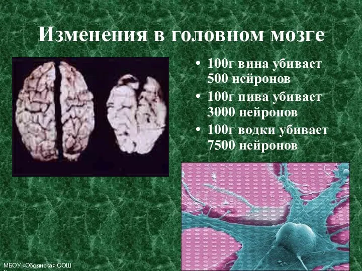 Изменения в головном мозге 100г вина убивает 500 нейронов 100г