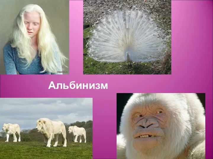 Альбинизм