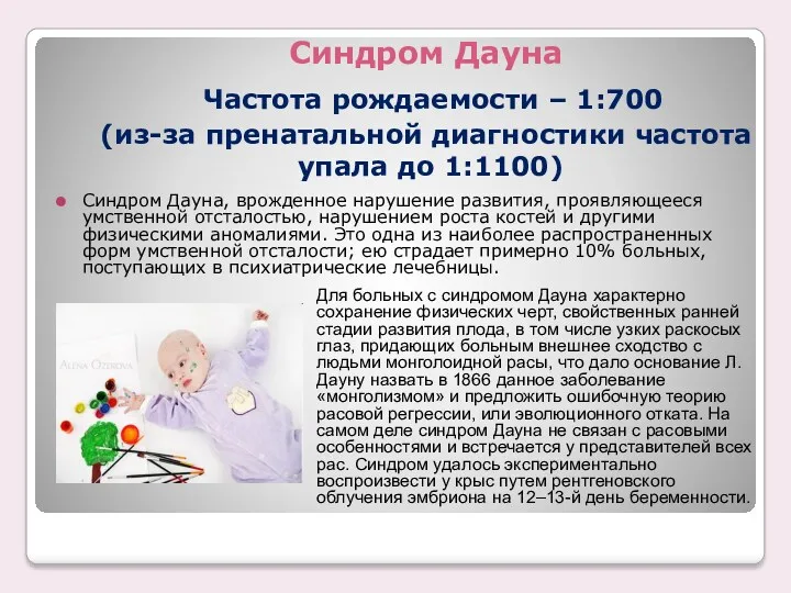 Синдром Дауна Частота рождаемости – 1:700 (из-за пренатальной диагностики частота