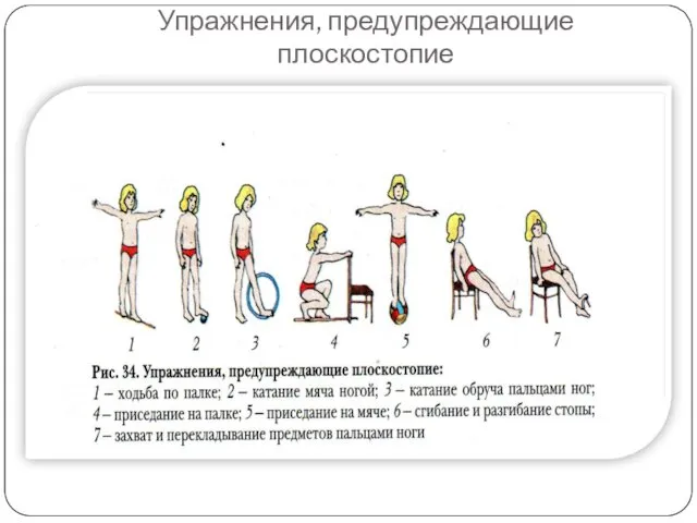 Упражнения, предупреждающие плоскостопие