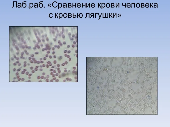 Лаб.раб. «Сравнение крови человека с кровью лягушки»