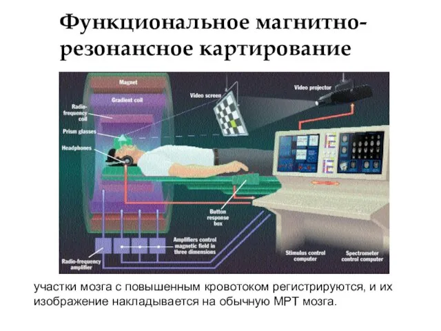 Функциональное магнитно-резонансное картирование участки мозга с повышенным кровотоком регистрируются, и