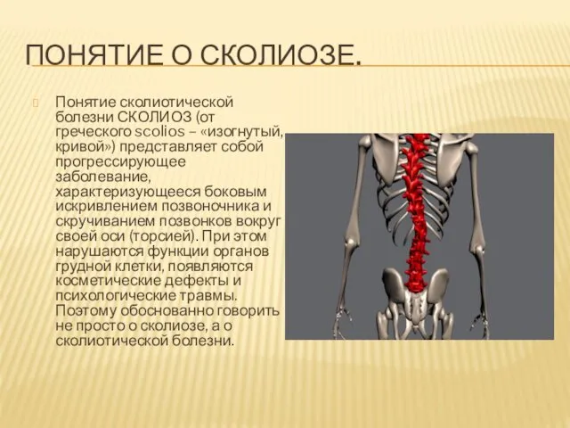 ПОНЯТИЕ О СКОЛИОЗЕ. Понятие сколиотической болезни СКОЛИОЗ (от греческого scolios