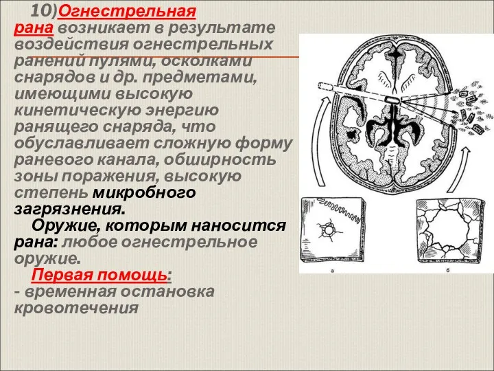 10)Огнестрельная рана возникает в результате воздействия огнестрельных ранений пулями, осколками