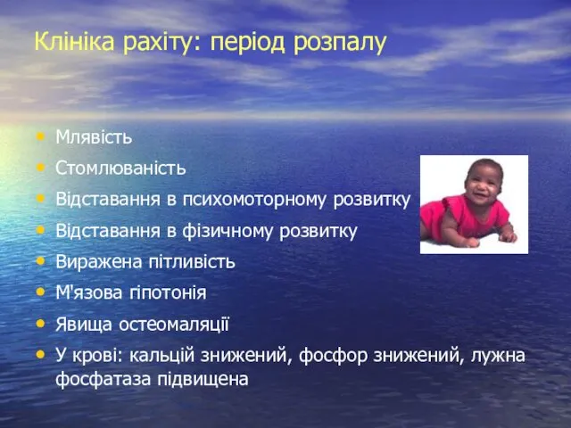 Клініка рахіту: період розпалу Млявість Cтомлюваність Відставання в психомоторному розвитку