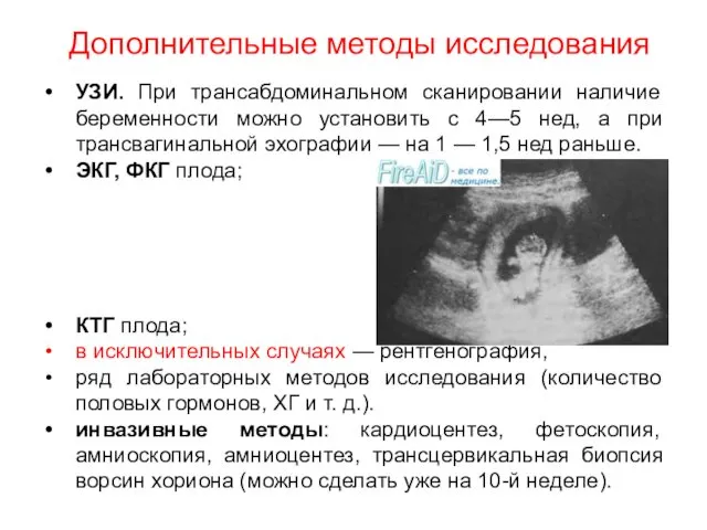 Дополнительные методы исследования УЗИ. При трансабдоминальном сканировании наличие беременности можно