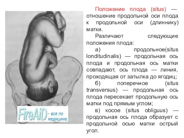 Положение плода (situs) — отношение продольной оси плода к продольной