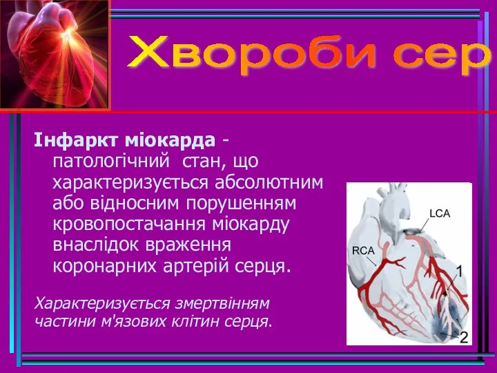 Хвороби серця Інфаркт міокарда - патологічний стан, що характеризується абсолютним