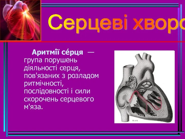 Серцеві хвороби Аритмі́ї се́рця — група порушень діяльності серця, пов'язаних