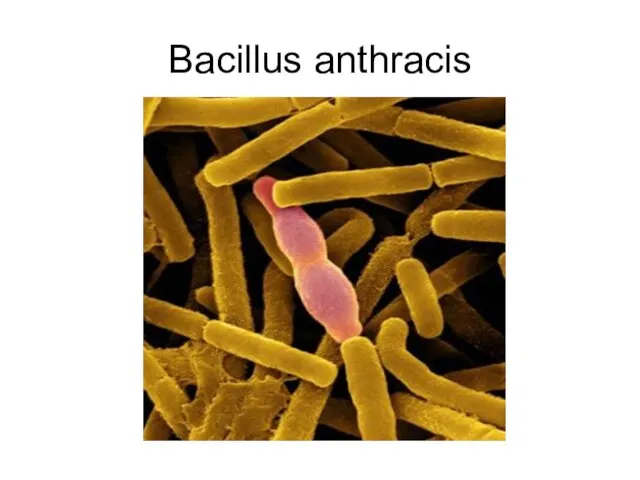 Bacillus anthracis