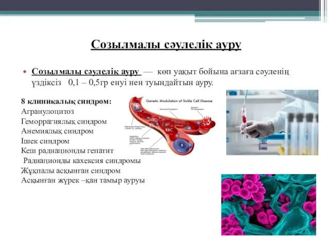 Созылмалы сәулелік ауру Созылмалы сәулелік ауру — көп уақыт бойына