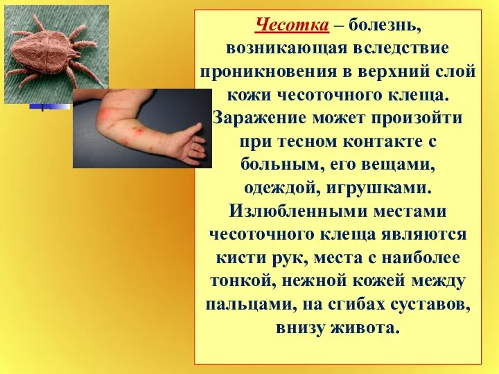 Чесотка – болезнь, возникающая вследствие проникновения в верхний слой кожи