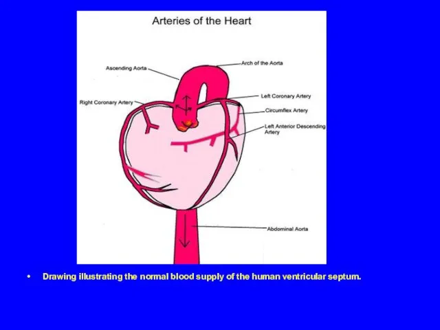 Drawing illustrating the normal blood supply of the human ventricular septum.