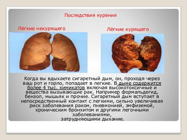 Последствия курения Лёгкие курящего Лёгкие некурящего Когда вы вдыхаете сигаретный дым, он, проходя