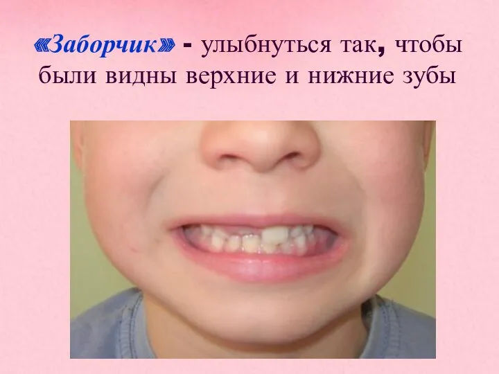 «Заборчик» - улыбнуться так, чтобы были видны верхние и нижние зубы