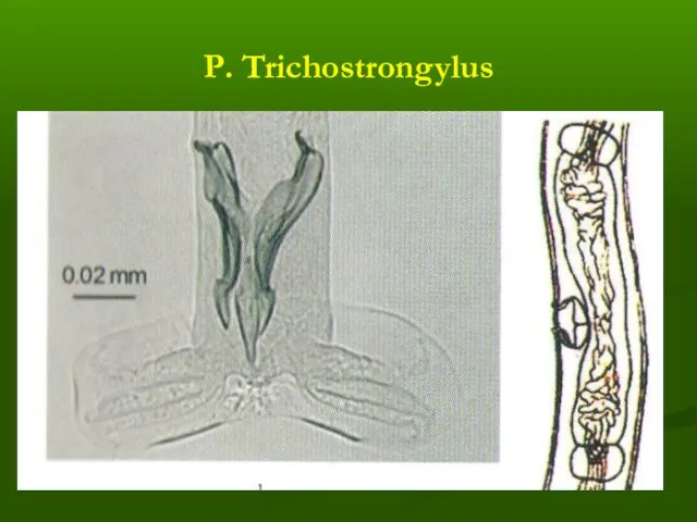 Р. Trichostrongylus