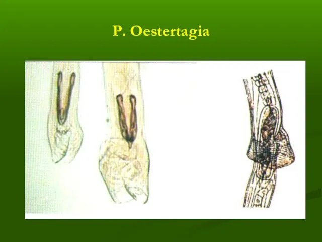 Р. Oestertagia