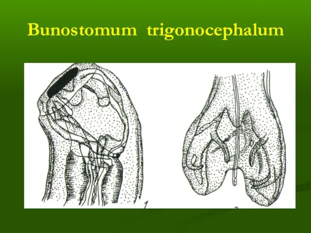 Bunostomum trigonocephalum