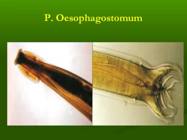 Р. Oesophagostomum