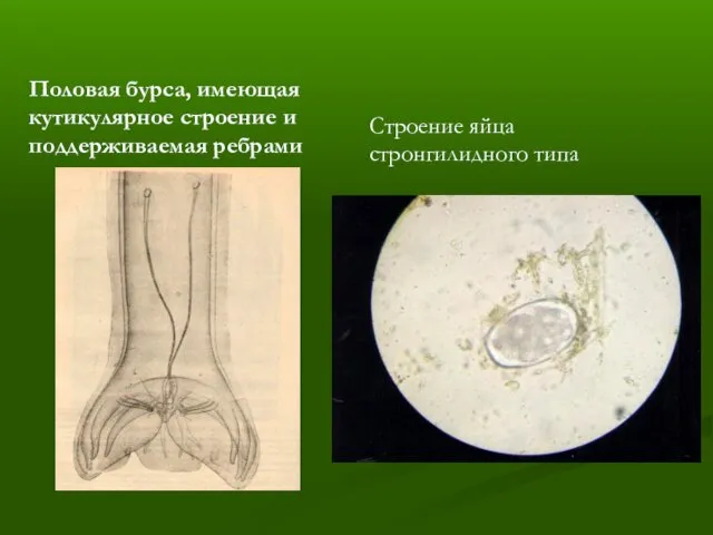 Половая бурса, имеющая кутикулярное строение и поддерживаемая ребрами Строение яйца стронгилидного типа