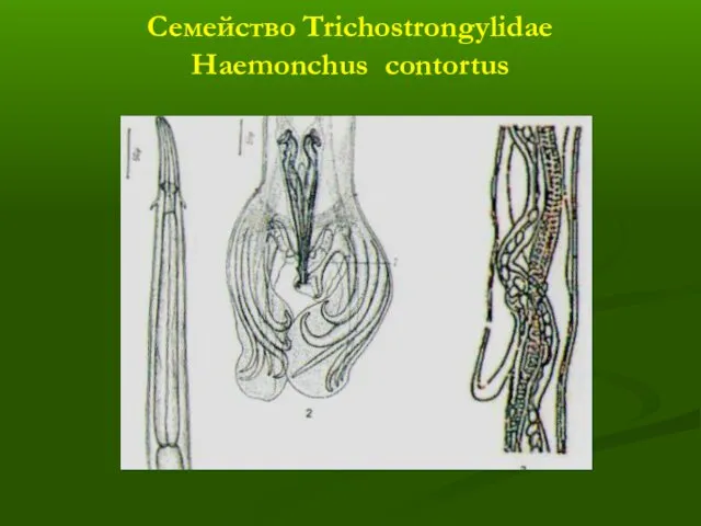 Семейство Trichostrongylidae Haemonchus contortus