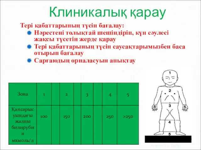 Клиникалық қарау Тері қабаттарының түсін бағалау: Нәрестені толықтай шешіндіріп, күн