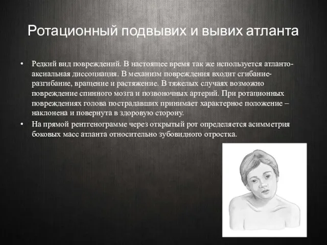 Ротационный подвывих и вывих атланта Редкий вид повреждений. В настоящее