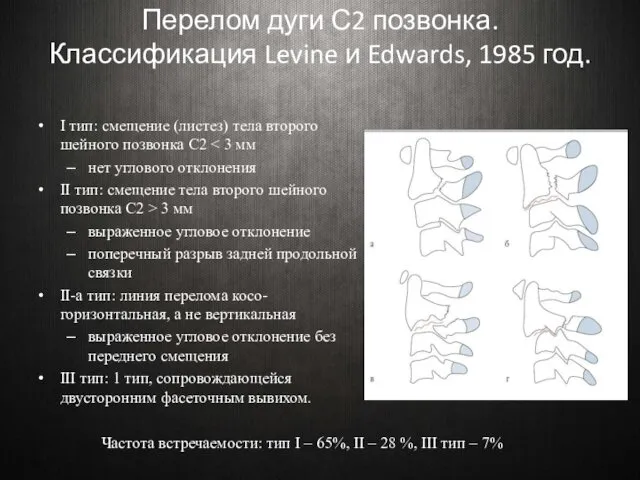 Перелом дуги С2 позвонка. Классификация Levine и Edwards, 1985 год.