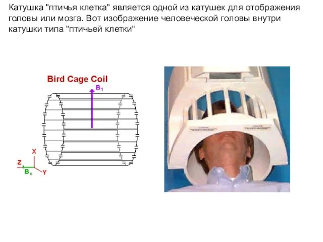 Катушка "птичья клетка" является одной из катушек для отображения головы
