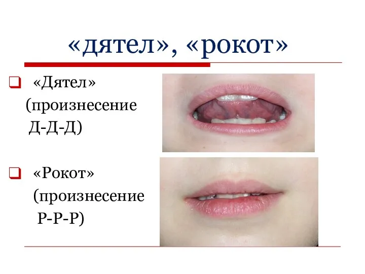 «дятел», «рокот» «Дятел» (произнесение Д-Д-Д) «Рокот» (произнесение Р-Р-Р)