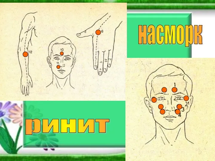 насморк ринит