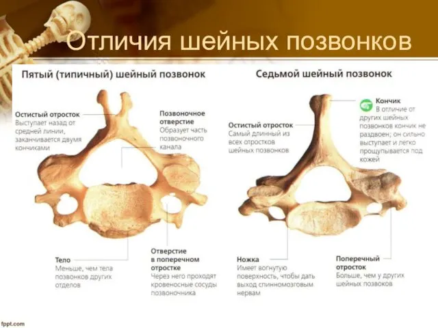 Отличия шейных позвонков Остистый отросток II-V позвонков раздвоен, тело небольшое,