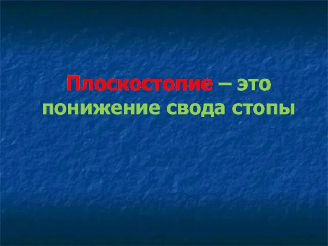 Плоскостопие – это понижение свода стопы