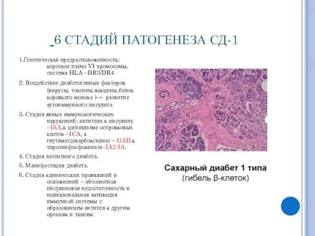 6 СТАДИЙ ПАТОГЕНЕЗА СД-1 1.Генетическая предрасположенность: короткое плечо VI хромосомы, система HLA –DR3/DR4