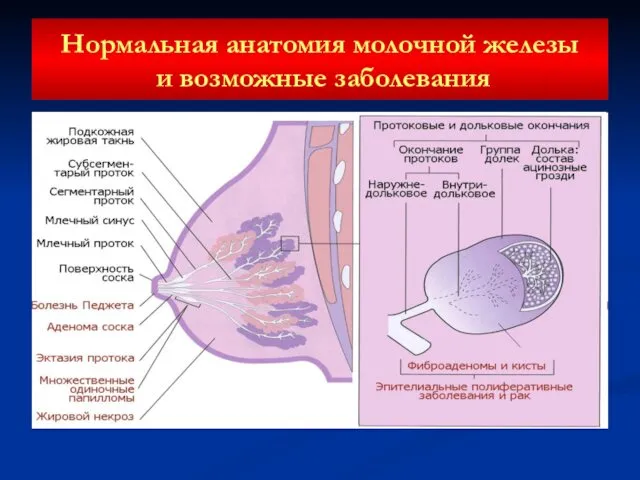 Нормальная анатомия молочной железы и возможные заболевания