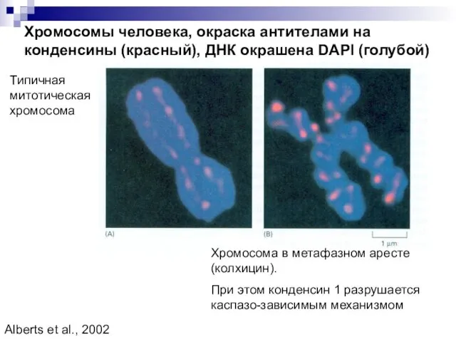 Хромосомы человека, окраска антителами на конденсины (красный), ДНК окрашена DAPI (голубой) Типичная митотическая